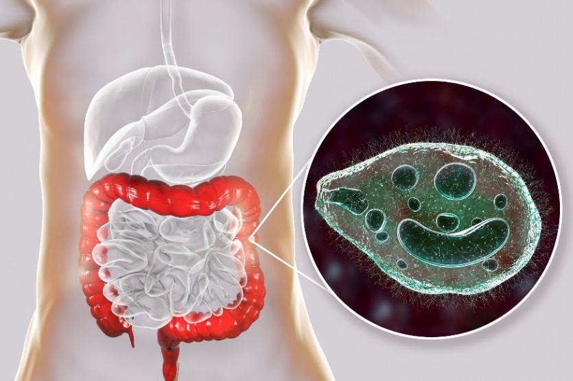 Balantidium coli - parazitas, užkrečiantis žmogaus virškinamojo trakto storąją žarną.