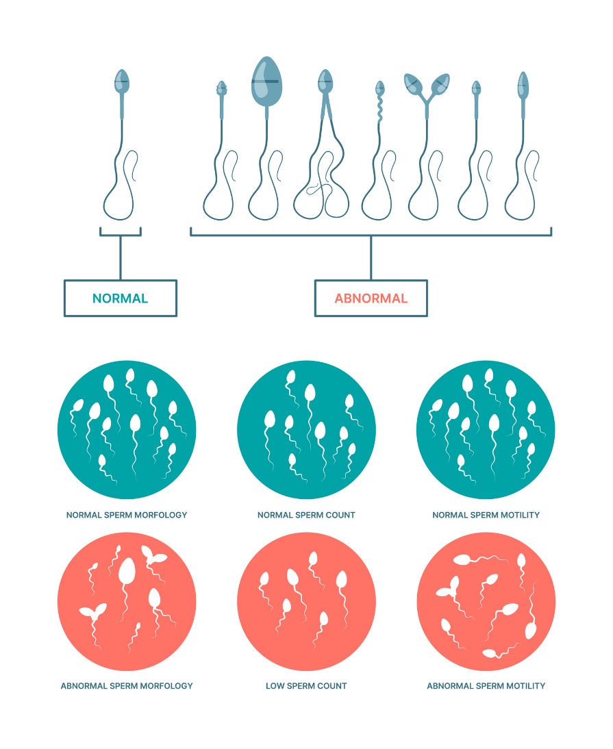 Fiziologinė ir nenormali spermatozoidų būklė. Spermatozoidų morfologija, skaičius ir judrumas