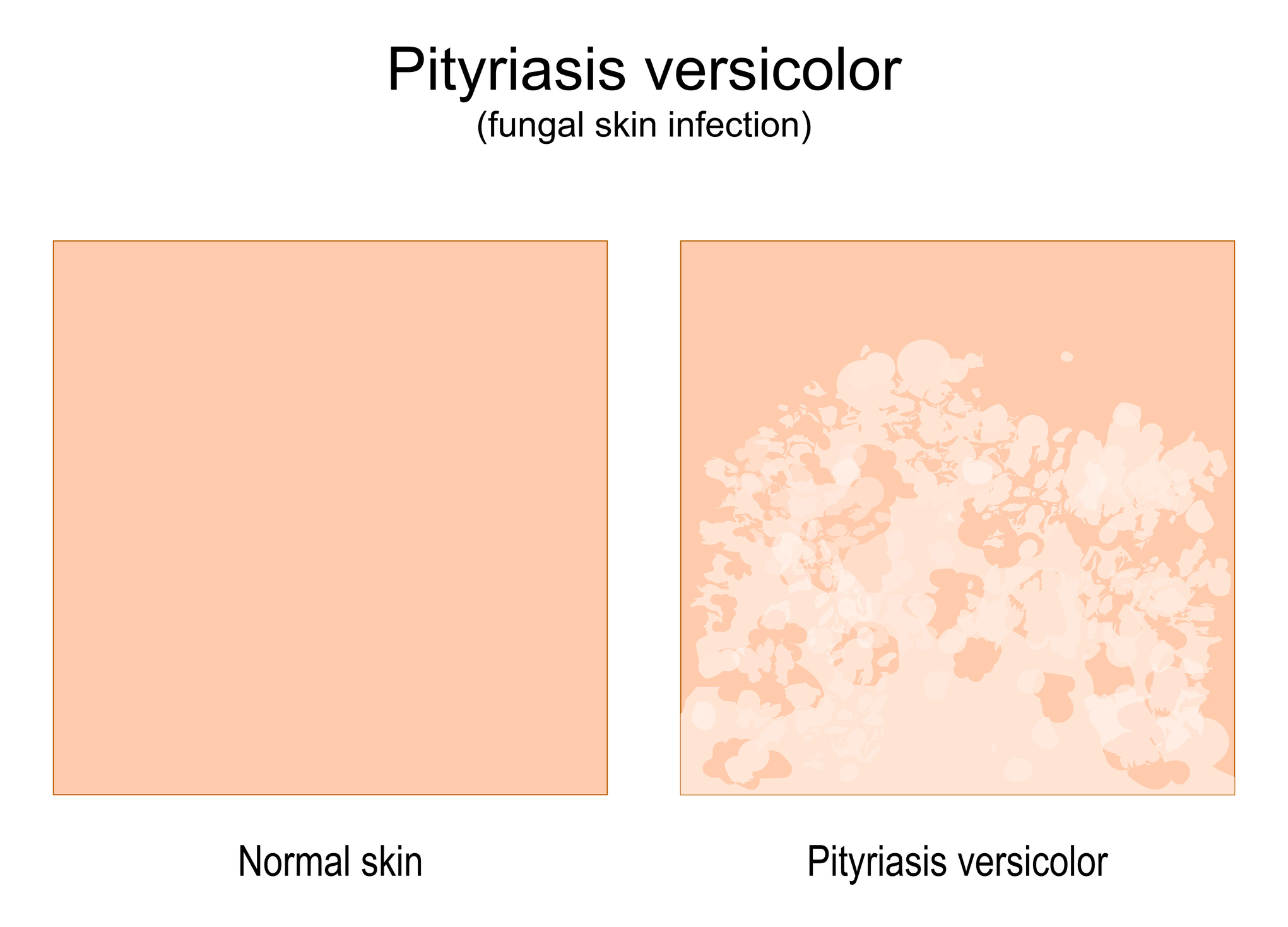 Normalios odos ir odos su ligos požymiais palyginimas