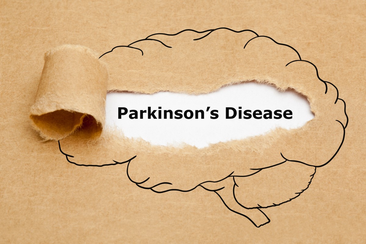 Morbus parkinson = Parkinsono liga = Parkinsono liga - smegenų su Parkinsono liga viduryje animacija