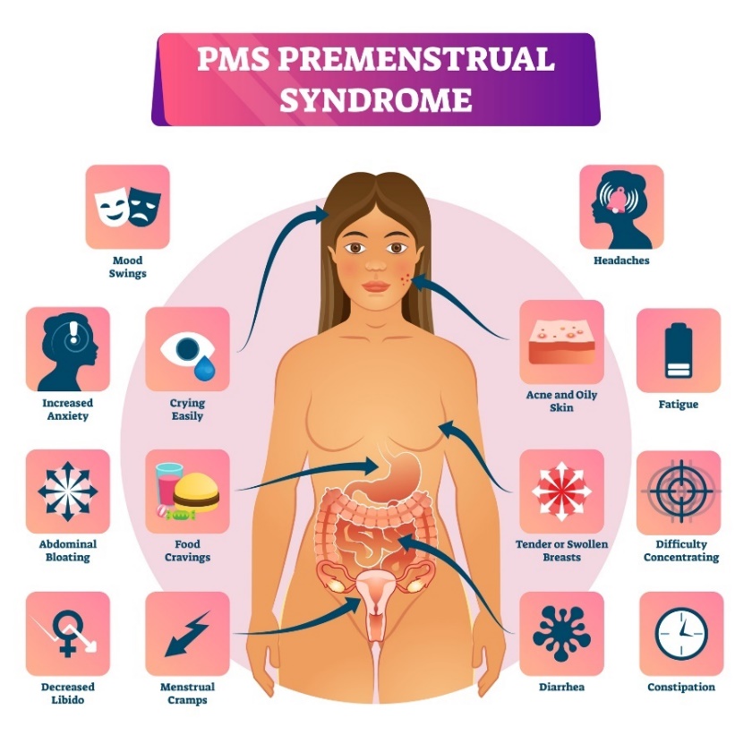 Priešmenstruacinis sindromas ir jo simptomai