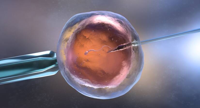 In vitro apvaisinimas IVF. Šaltinis: Getty Images