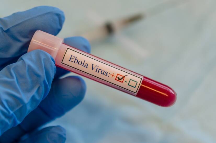 Ebola: kokie yra simptomai?