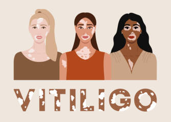 Vitiligo: kas yra vitiligo, kokios yra jo priežastys ir simptomai? Kada jis prasideda?